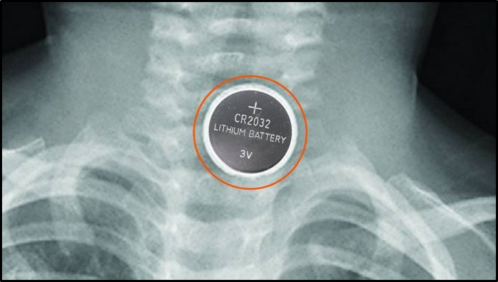 Stuff Article: Risk of swallowing deadly button batteries prompts new industry safety policy